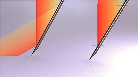 Vergleich Ultraschallreflexion Standardnadel (links) mit TOP Echogene Sonografie-Nadel (rechts)